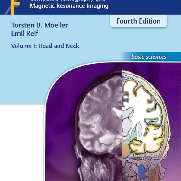 Pocket Atlas of Sectional Anatomy, Vol. 1: Head and Neck, Computed Tomography and Magnetic Resonance Imaging, Fourth Edition