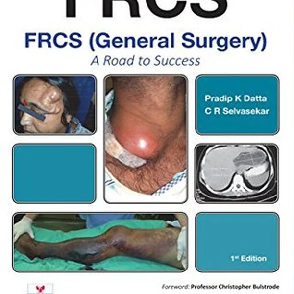 FRCS (General Surgery): A Road to Success 1st Edition