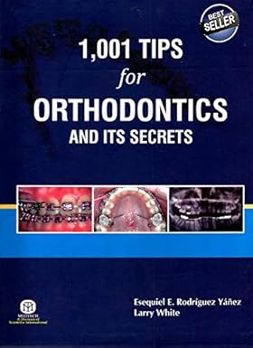 1001 Tips For Orthodontics And Its Secrets