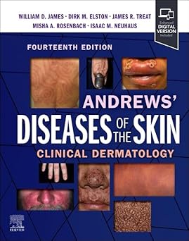 Andrews' Diseases of the Skin: Clinical Dermatology