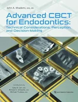Advanced CBCT for Endodontics