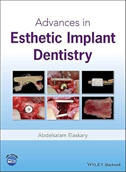 Advances in Esthetic Implant Dentistry