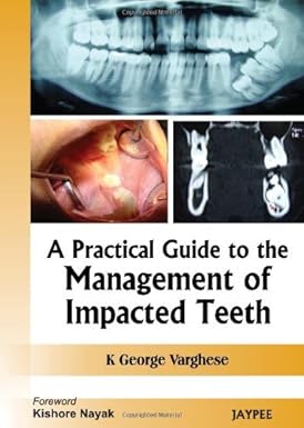 A Practical Guide to the Management of Impacted Teeth