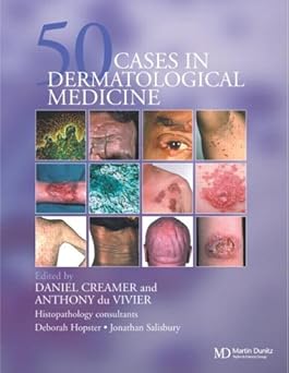 50 Cases in Dermatological Medicine