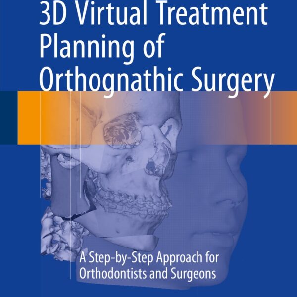 3D Virtual Treatment Planning of Orthognathic Surgery: