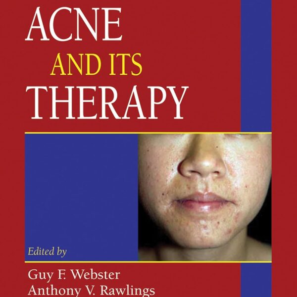 Acne and Its Therapy