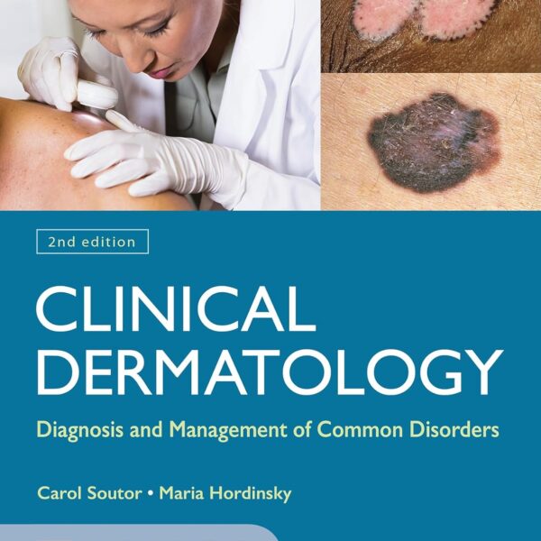 Clinical Dermatology: Diagnosis and Management of Common Disorders
