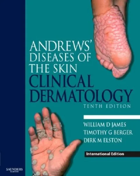 Andrews' Diseases of the Skin: Clinical Dermatology