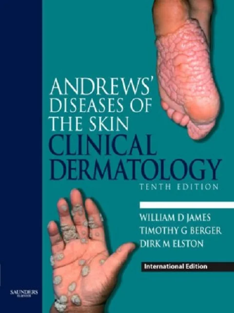 Andrews' Diseases of the Skin: Clinical Dermatology