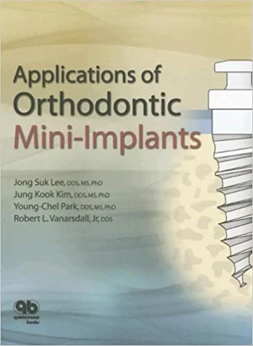 orthodontic mini implants book